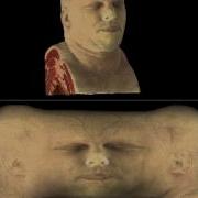 Visible Human Project Male Head