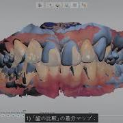 3ShapeTRIOS Мониторинг состояния пациента базовое введение