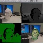 KinectFusion For Medical Augmented Reality