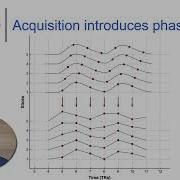 13 Preprocessing FMRI Data Slice Time Correction