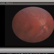 How To Use Optomed Smartscope Viewer Software