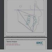 CephX Downloading Cephalometric Analysis