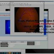 Analysis On Retinal Diseases Using Machine Learning Algorithms Matlab Project 91 83000 15425