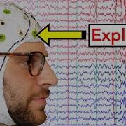 EEG Electroencephalogram Explained