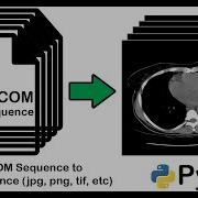 How To Convert A DICOM File Into An Image Jpg Png Tif Etc Using Python Sequence DICOM Files
