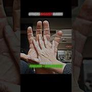 BIGGEST Hands In The World Strongest Arms