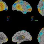 EEG Source Estimation Using The Brainstorm Toolbox