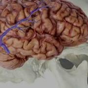 New First Aid For Stroke With Nick Rondinelli Heart2Heart First Aid Training Toronto