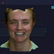Smile Makeover Oral Design Cleveland 3D Facial Scan RayFace Ray America Cleveland OH