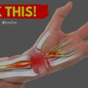 How To Fix Wrist Pain For Good