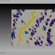 Easy Shallow Learning With Ilastik