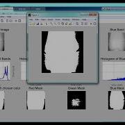 Bone Fractures Detection Using Matlab Code Top 5 Matlab Projects