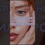 Филлер в носогубку филлер филлеры носогубка носогубныескладки ботокс
