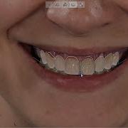 3Shape Smile Design