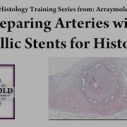 A Low Cost Method For Processing Tissues With Metallic Stents