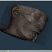 VTK Python Example MedicalDemo4