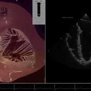 Which Scallop