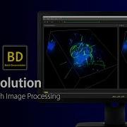 Batch Deconvolution In Action Automated Image Processing NIS Elements