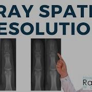 X Ray Spatial Resolution Focal Spot Motion Detector