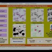 Malaria Detection Using Neural Network In Matlab Project Source Code