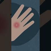 How To Heal Blisters Shorts