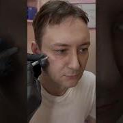 Коррекция средней трети лица филлерами контурнаяпластика скулы филлеры подбородок косметолог