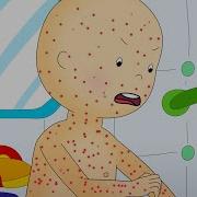 Chicken Pox Caillou Cartoon