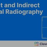 Digital Radiography DR System Explained