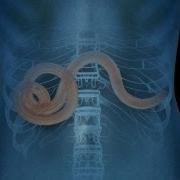 Why Parasites May Not Be All That Bad