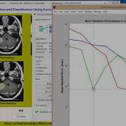 Brain Tumor Detection Using Convolutional Neural Network CNN Using Matlab Project Source Code