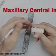 Carving The Maxillary Central Incisor