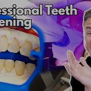 How Teeth Whitening At The Dentist Works And Is It Worth It Orthodontist Reacts