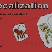 Quick Guide To Colocalization In Fiji ImageJ