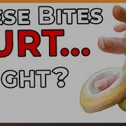Ball Python Bites Seek Medical Care Immediately Right