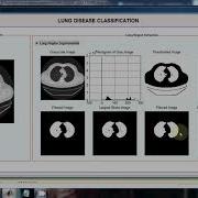 Lung Disease Classification Using Machine Learning Medical Image Processing Projects MATLAB