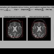 Edge Based Segmentation Geodesic Active Contours Snakes Level Sets Curvature Motion Python