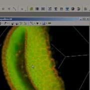 AutoQuant Deconvolution 5D Viewer 3D Visualization