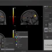 BrainMagix SPM Viewer Demo