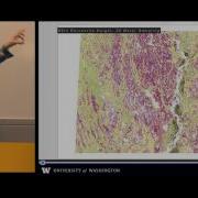 Spatial Patterns Of Canopy Structure UW GIS Day 2015