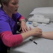 Allergy Scratch Testing
