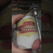 Complete Denture Course Occlusion For Dentures