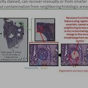Profiling Focal Areas Of FFPE Tissue Spatial Transcriptomics And The Challenge Of Low Input Samples