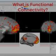 CONN Tutorial 1 What Is Functional Connectivity