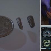 Dental Implants Fail Millions Of Patients