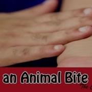 First Aid How To Treat An Animal Bite