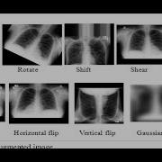 Data Augmentation On A Single Image Part 1 Of 3