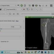 3D Slicer Volume Cropping Threshold Tool