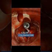 Colonoscopy Dr Paulien Moyaert