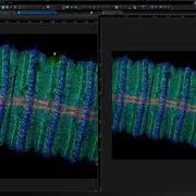 Confocal Image Vs Deconvolution How To Save Z Projection Image Using CellSens D