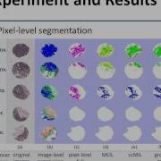 Context Constrained Multiple Instance Learning For Histopath
